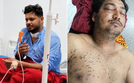 CJP के संसद मार्च में RAF जवान ने चलाई पेलेट गन? जांच में बड़ा खुलासा, CRPF ने शुरू की आंतरिक पड़ताल