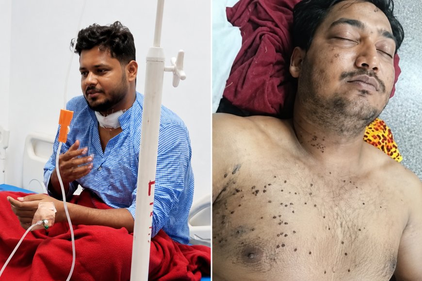 CJP के संसद मार्च में RAF जवान ने चलाई पेलेट गन? जांच में बड़ा खुलासा, CRPF ने शुरू की आंतरिक पड़ताल